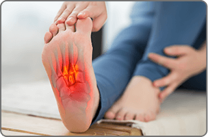 Plantar Fasciitis​