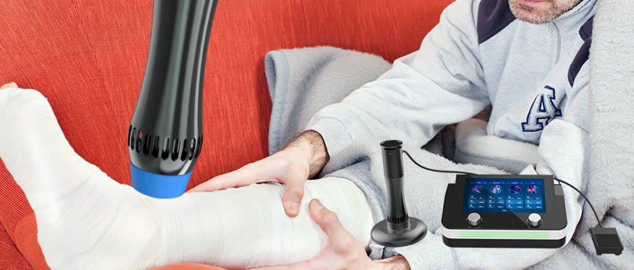 Shockwave Therapy of Fracture Nonunion​