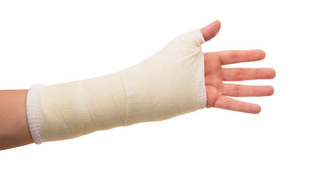 Shockwave Therapy's Magic Touch on Fractures