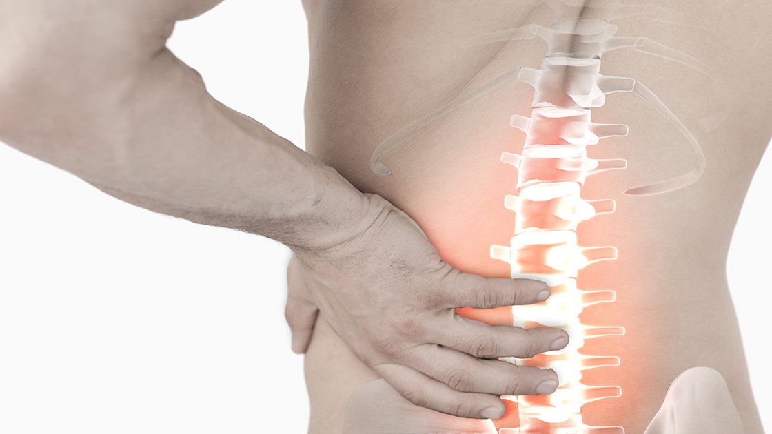 Is Shockwave Therapy Suitable for Treating Herniated Discs？