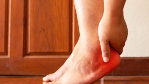 Embrace Relief with Shockwave for Plantar Fasciitis