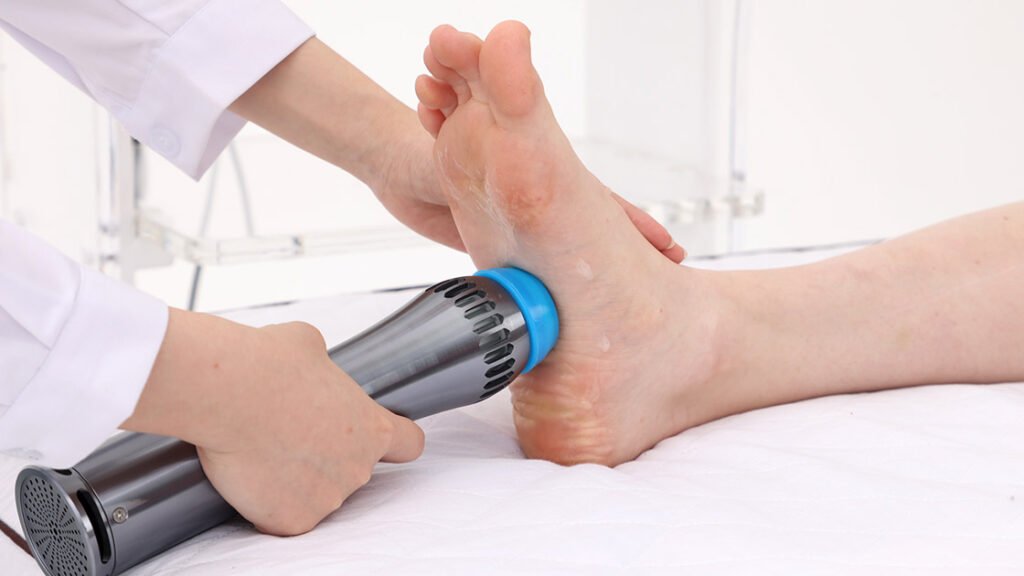 Shockwave Therapy for Plantar Fasciitis